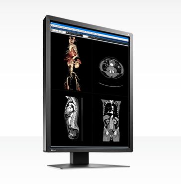 Monitory medyczne Eizo RadiForce MX216