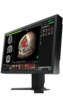Monitory medyczne Eizo RadiForce MX220W
