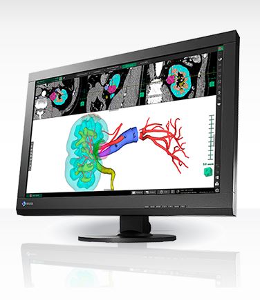 Monitory medyczne Eizo RadiForce MX242W
