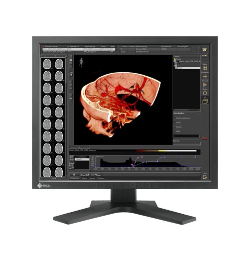 Monitory medyczne Eizo RadiForce RS110