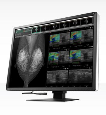 Monitory medyczne Eizo RadiForce RX1270
