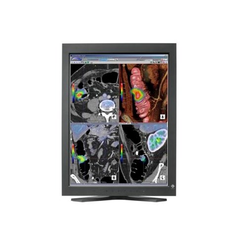 Monitory medyczne Eizo RadiForce RX220