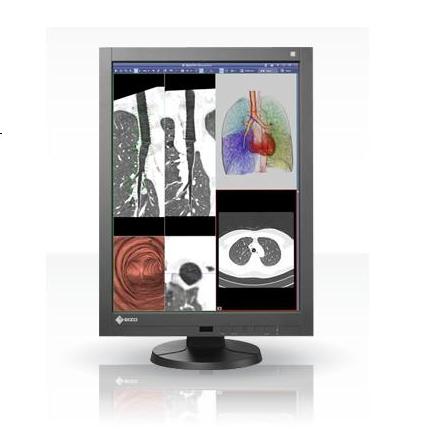 Monitory medyczne Eizo RadiForce RX240