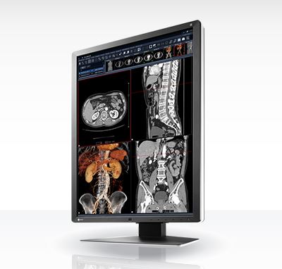 Monitory medyczne Eizo RadiForce RX250