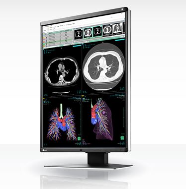 Monitory medyczne Eizo RadiForce RX360
