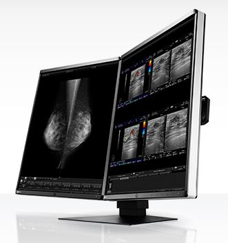 Monitory medyczne Eizo RadiForce RX560