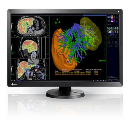 Monitory medyczne Eizo RadiForce RX650