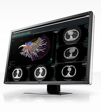 Monitory medyczne Eizo RadiForce RX660