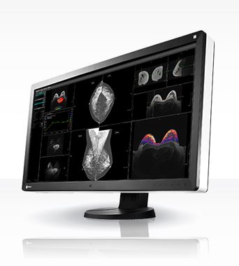 Monitory medyczne Eizo RadiForce RX850