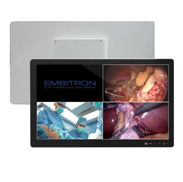 Monitory medyczne Embitron MBT-1000.55.1