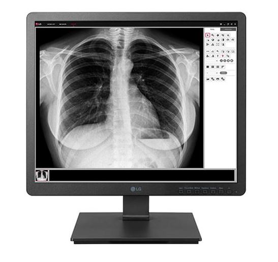 Monitory medyczne LG 19HK312C