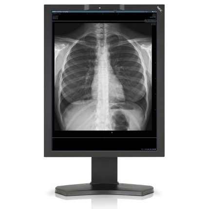 Monitory medyczne NEC MD210C3