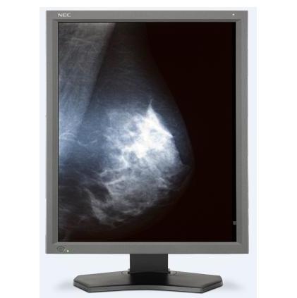 Monitory medyczne NEC MD211G5