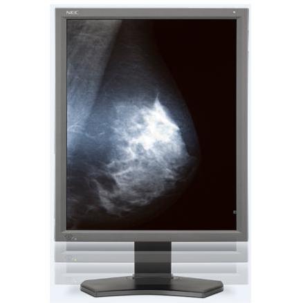 Monitory medyczne NEC MD211G5