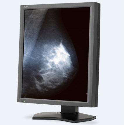 Monitory medyczne NEC MD211G5