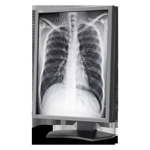 Monitory medyczne NEC MD212G3