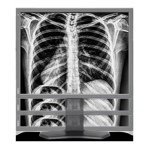 Monitory medyczne NEC MD212G3