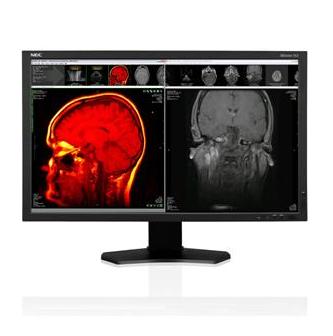 Monitory medyczne NEC MDview 243