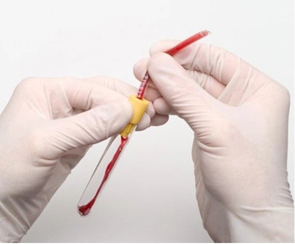 Nakłuwacze do drenów z krwią BBS Securdrop