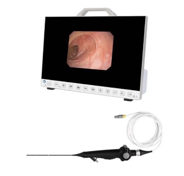 Nasofaryngoskopy (Videonasofaryngoskopy) B/D TU-RH