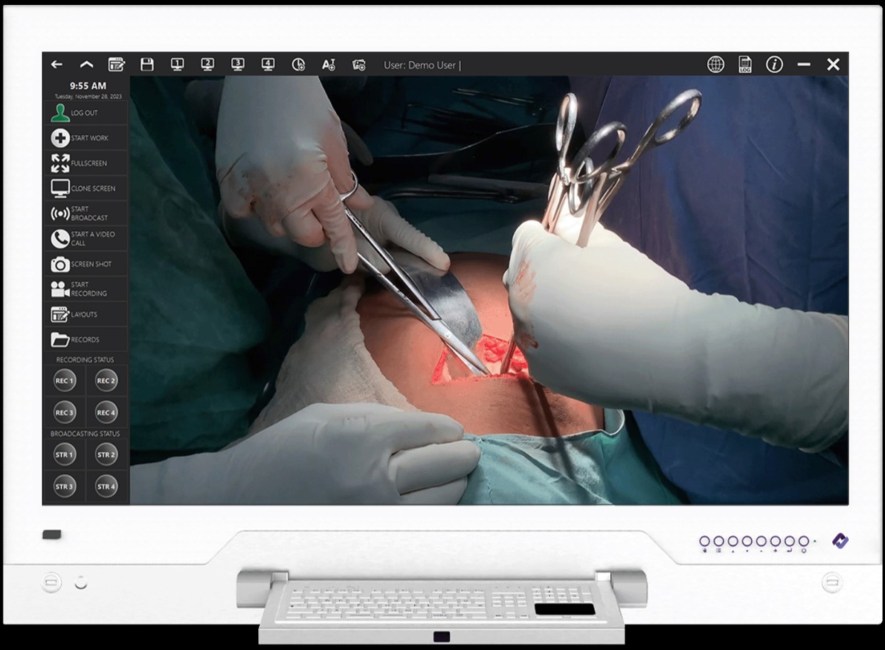 Negatoskopy cyfrowe na salę operacyjną CureLink CureLink