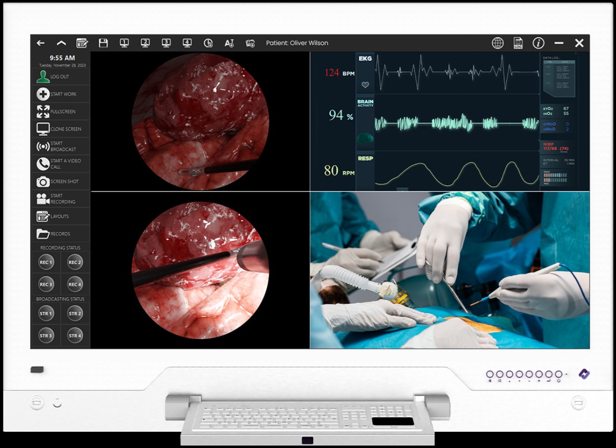 Negatoskopy cyfrowe na salę operacyjną CureLink CureLink