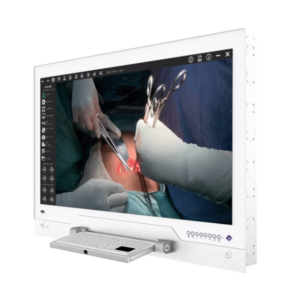 Negatoskopy cyfrowe na salę operacyjną CureLink CureLink