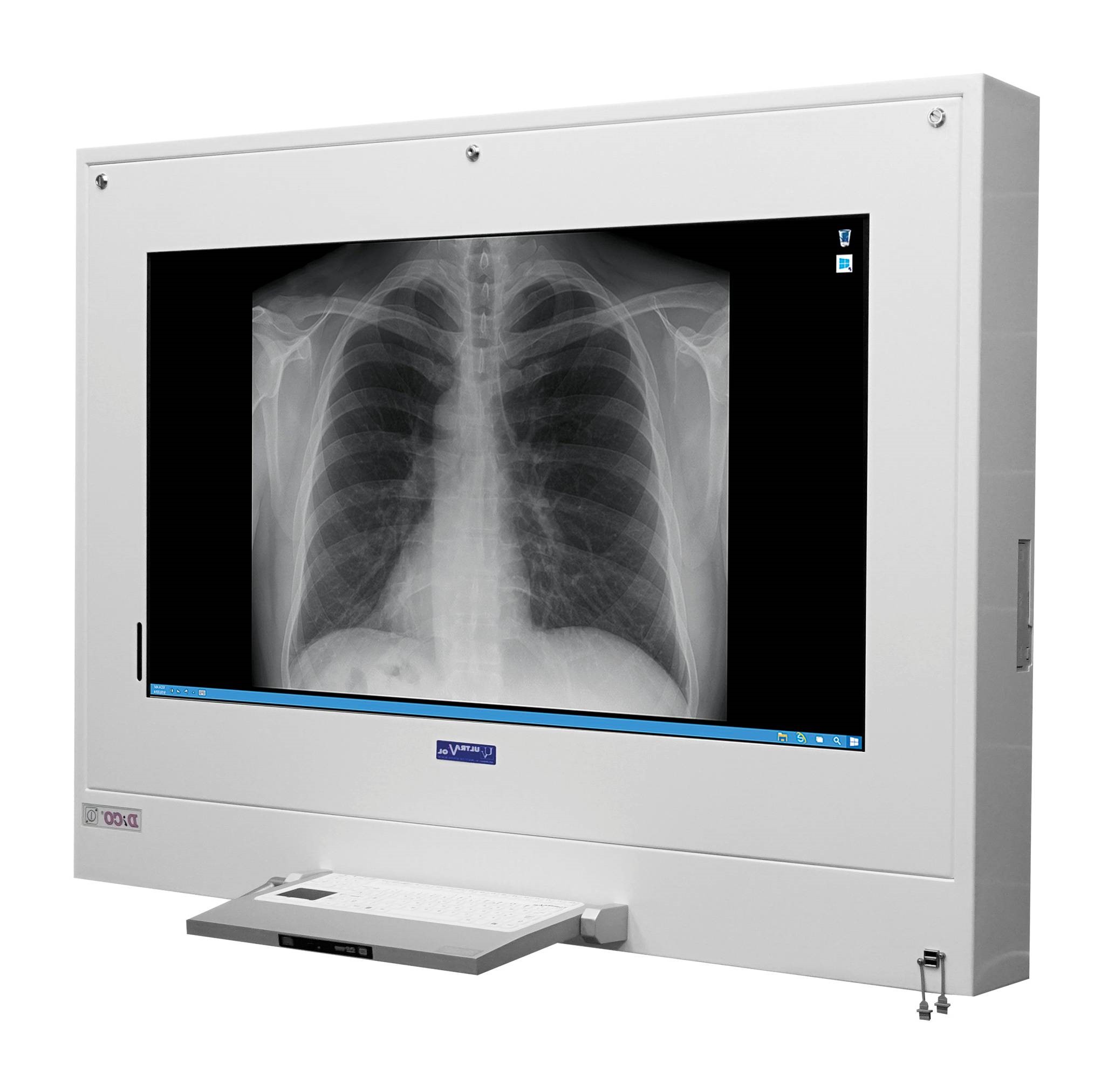 Negatoskopy cyfrowe na salę operacyjną ULTRAVIOL All in One Dico 24"
