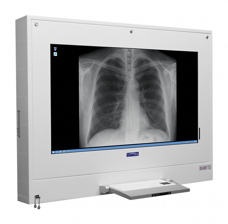 Negatoskopy cyfrowe na salę operacyjną ULTRAVIOL DICO 1M 43"