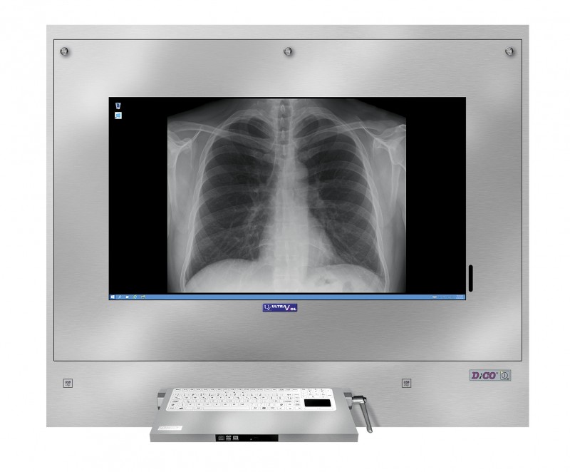 Negatoskopy cyfrowe na salę operacyjną ULTRAVIOL DICO 1M 43"