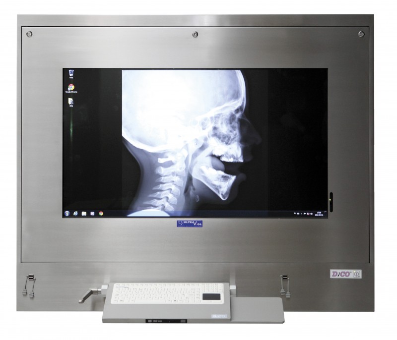 Negatoskopy cyfrowe na salę operacyjną ULTRAVIOL DICO 1M 43" -  NEGATOSKOP RZEGLĄDOWY CYFROWYCH OBRAZÓW MED.