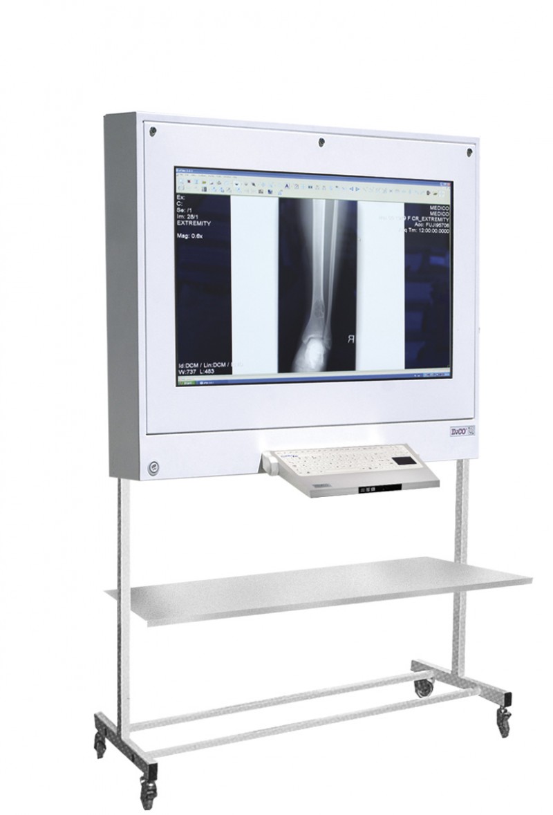 Negatoskopy cyfrowe na salę operacyjną ULTRAVIOL DICO 1M 43" -  NEGATOSKOP RZEGLĄDOWY CYFROWYCH OBRAZÓW MED.