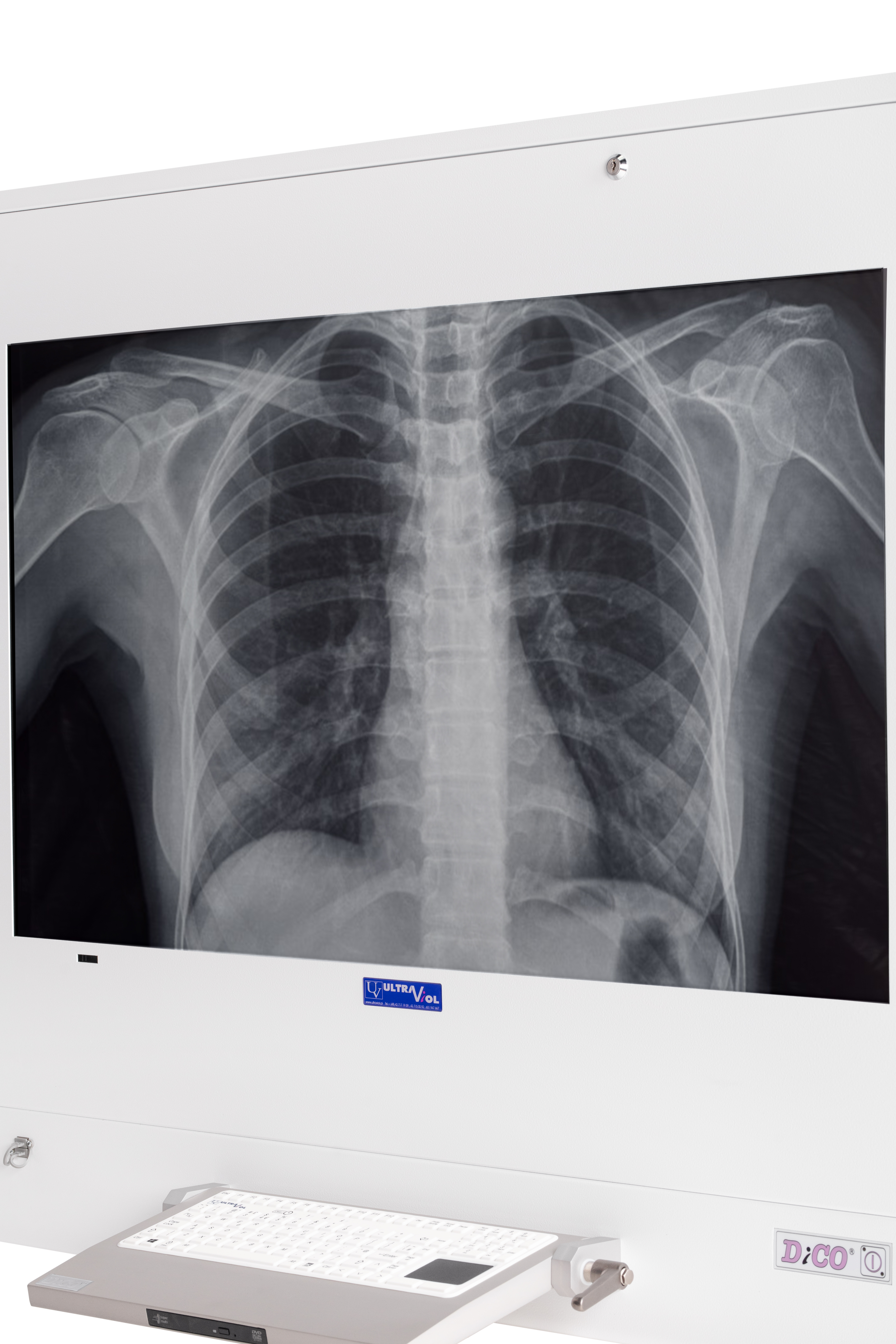 Negatoskopy cyfrowe na salę operacyjną ULTRAVIOL DICO 1M 49"
