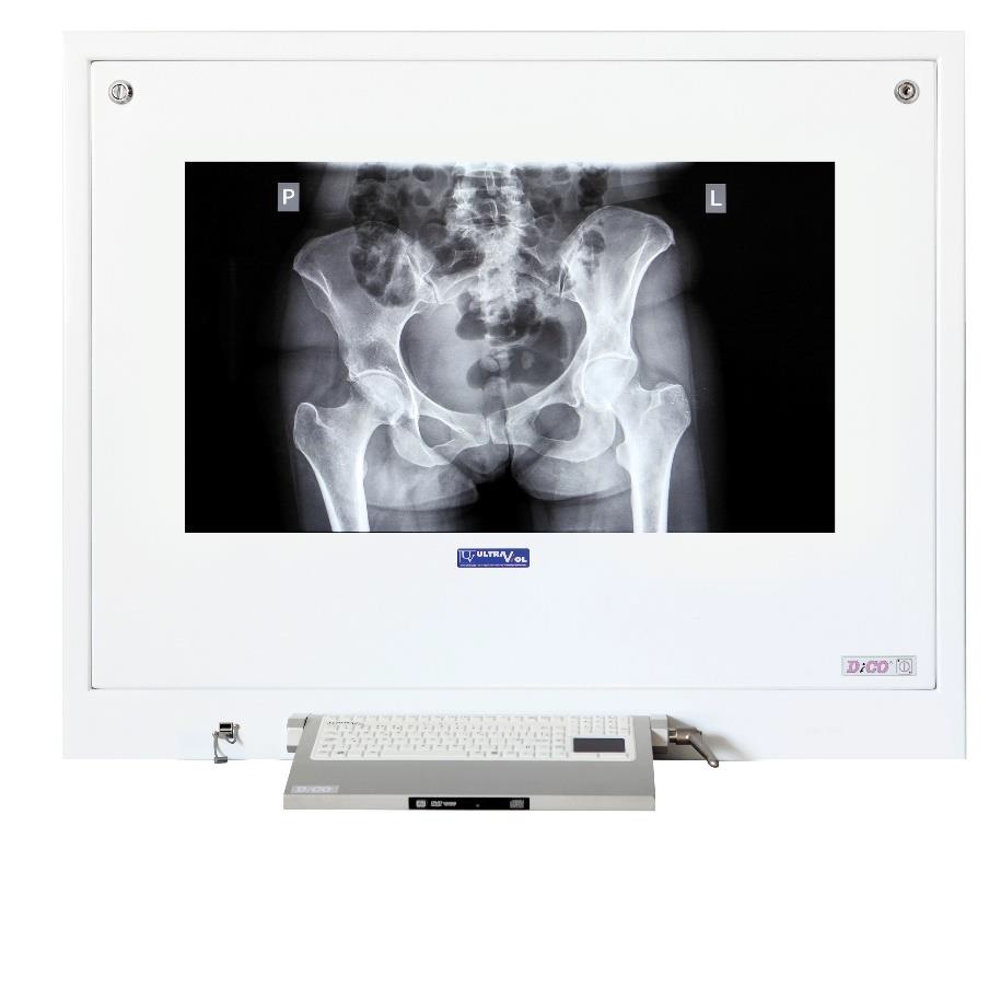 Negatoskopy cyfrowe na salę operacyjną ULTRAVIOL DICO 1M 55" NEGATOSKOP RZEGLĄDOWY CYFROWYCH OBRAZÓW MED.