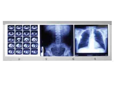 Negatoskopy SLIM LED Rego X-Ray GmbH X-ray Viewing Boxes