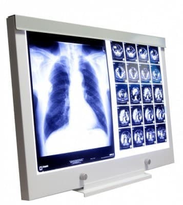 Negatoskopy SLIM LED ULTRAVIOL LED NGP 11/LED NGP 21/LED NGP 31/LED NGP 41