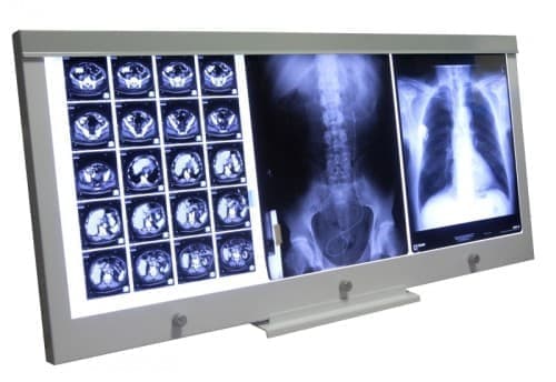 Negatoskopy SLIM LED ULTRAVIOL LED NGP 31 - negatoskop trzyklatkowy