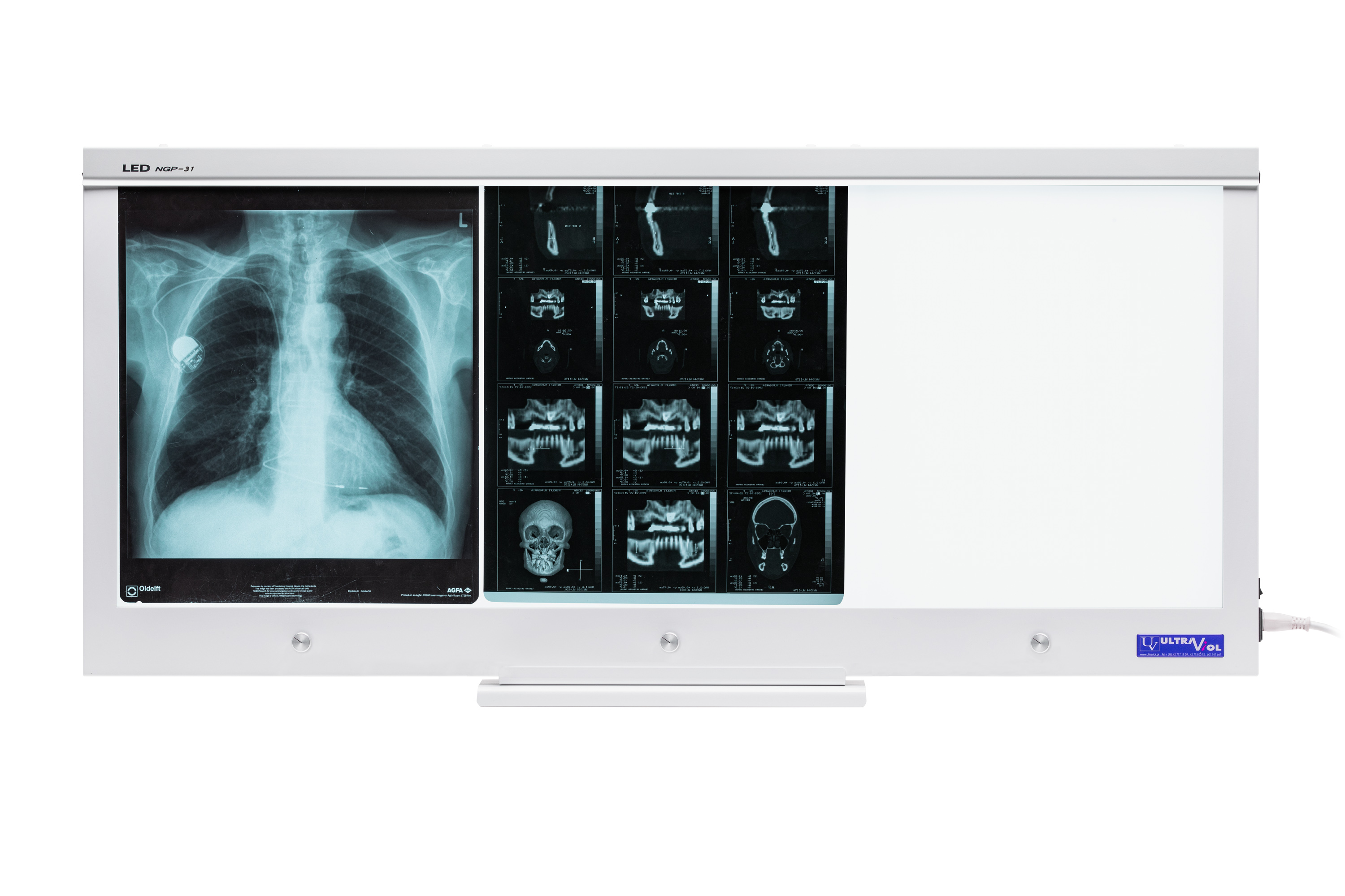 Negatoskopy SLIM LED ULTRAVIOL LED NGP 31 - negatoskop trzyklatkowy