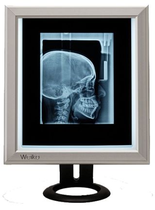 Negatoskopy SLIM LED Weiko BFSL 50.1 T1