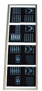 Negatoskopy SLIM LED Weiko BFSL 50.4 VE