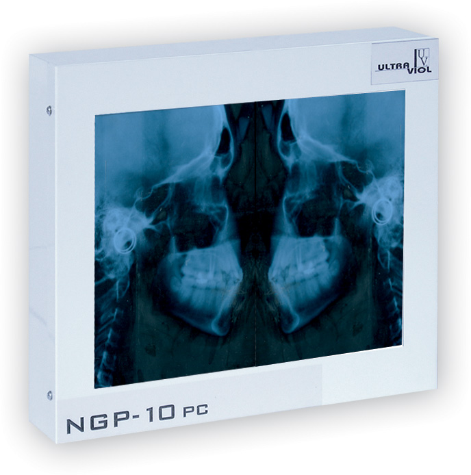 Negatoskopy stomatologiczne ULTRAVIOL CEFALOM 01 - negatoskop stomatologiczny