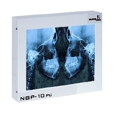 Negatoskopy stomatologiczne ULTRAVIOL CEFALOM 01 - negatoskop stomatologiczny