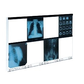 Negatoskopy wysokiej częstotliwości ULTRAVIOL NGP80HF - negatoskop ośmoklatkowy (NGP 80 HF)