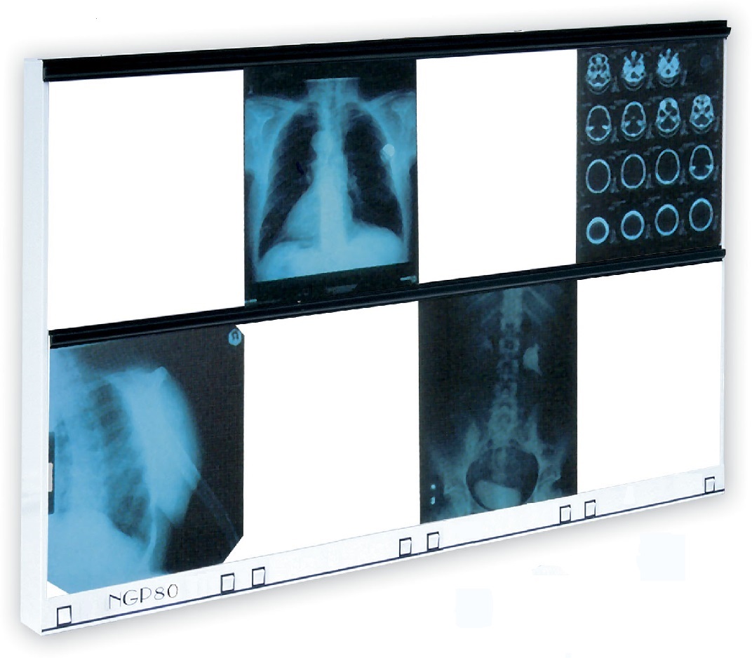 Negatoskopy z podziałem na klatki ULTRAVIOL NGP80HF - negatoskop ośmoklatkowy (NGP 80 HF)
