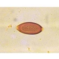 Odczynniki uniwersalne do mikroskopii Apacor Odczynniki do analiz parazytologicznych