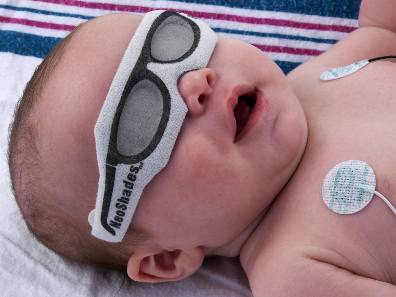 Okulary do fototerapii bilirubinowej NEOTECH NeoShades with  Tabs