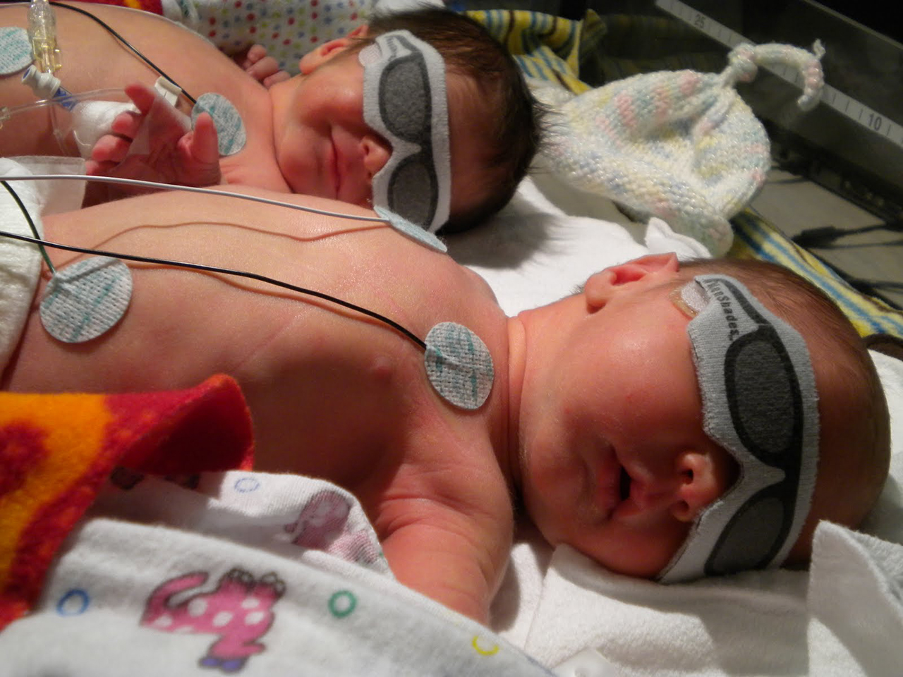 Okulary do fototerapii bilirubinowej NEOTECH NeoShades with  Tabs