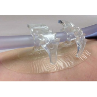 Opatrunki mocujące (cewnik, dren, kaniula) Bioderm UniGrip