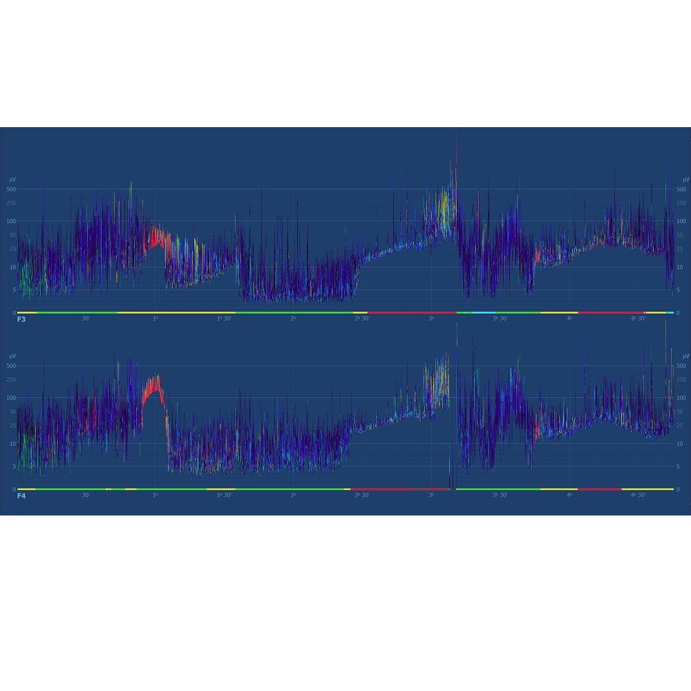 Oprogramowanie do analizy EEG ELMIKO do analizy EEG