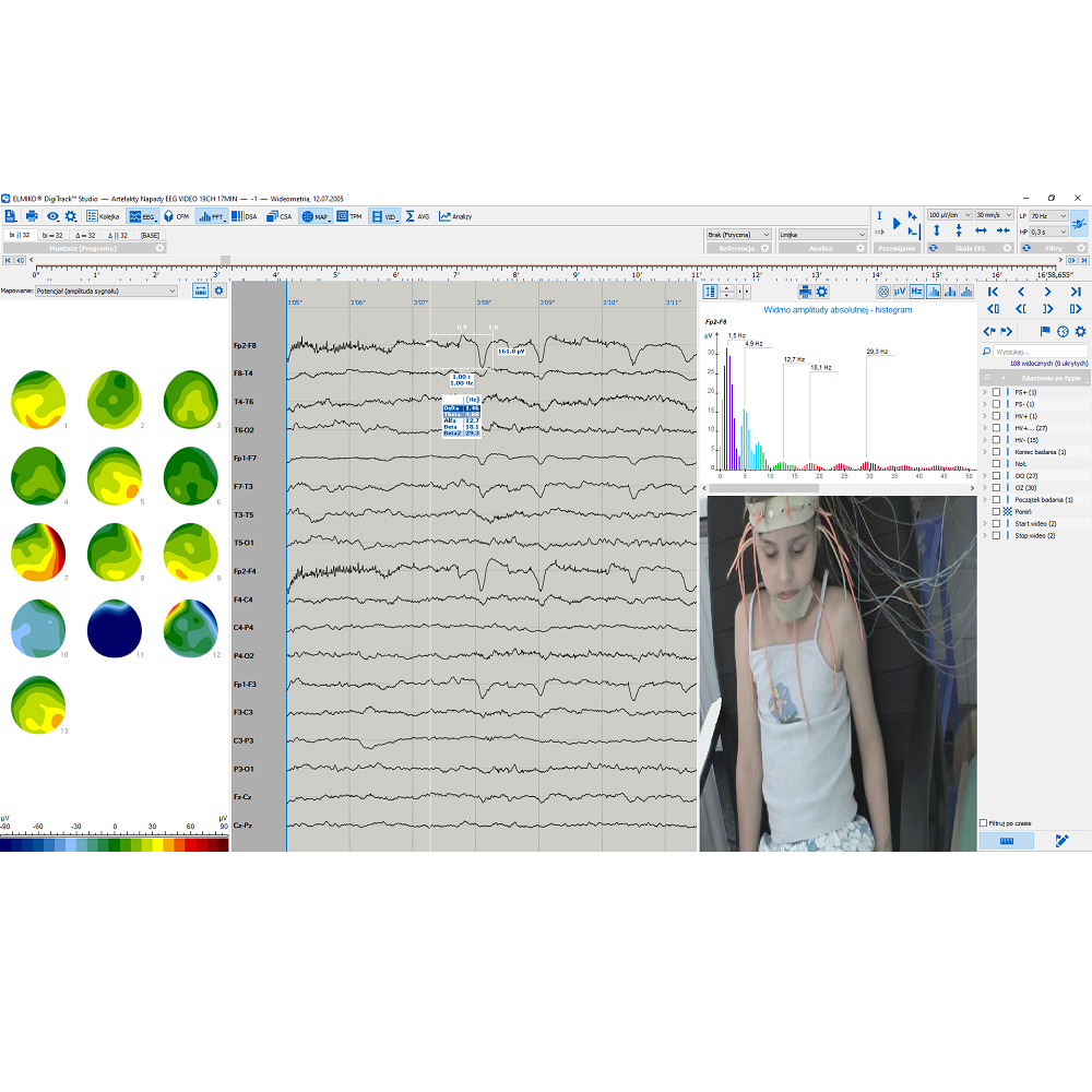 Oprogramowanie do analizy EEG ELMIKO do analizy EEG